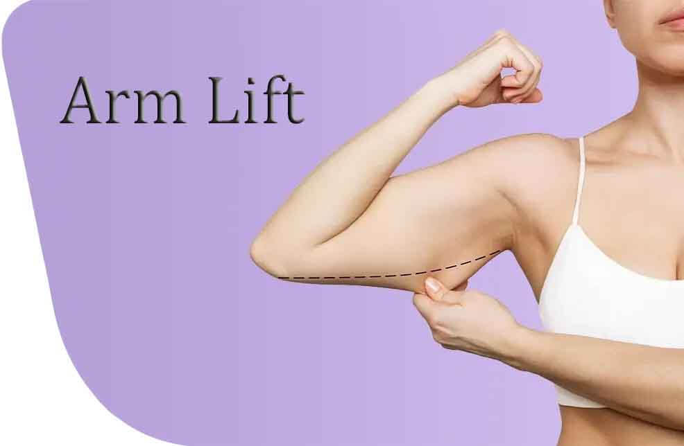 Picture of the abdomen before body conturing plastic surgery