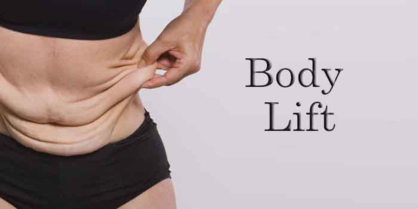 Picture of the abdomen before body conturing plastic surgery